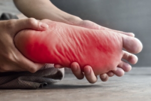 Diabetic Neuropathy and the Feet