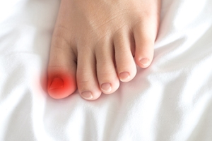 Ingrown Toenails and Podiatric Care