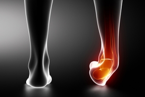 What Podiatrists Can Do for Ankle Sprains