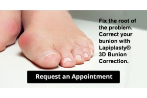 Painful Bunions? There&#039;s a New Treatment Option in Lapiplasty®