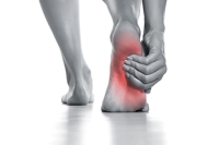 Reasons for Arch Pain